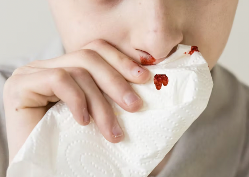 Person biting a tissue with red lipstick marks and blood on their lips.