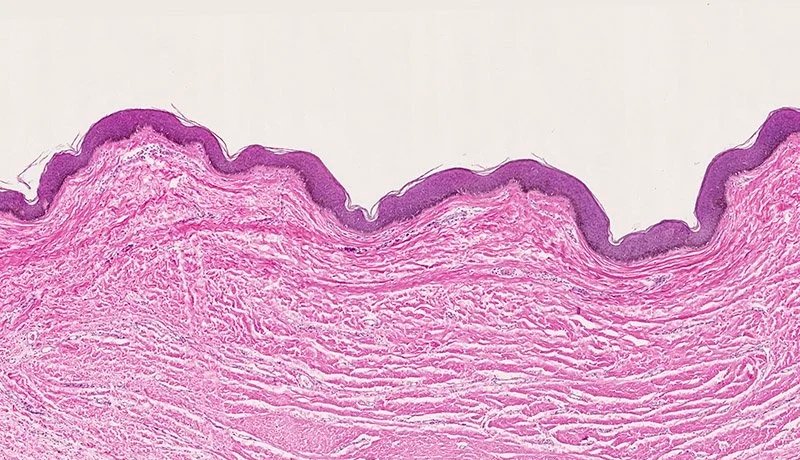 Close-up microscopic image of tissue sample with layered structure, stained pink and purple.