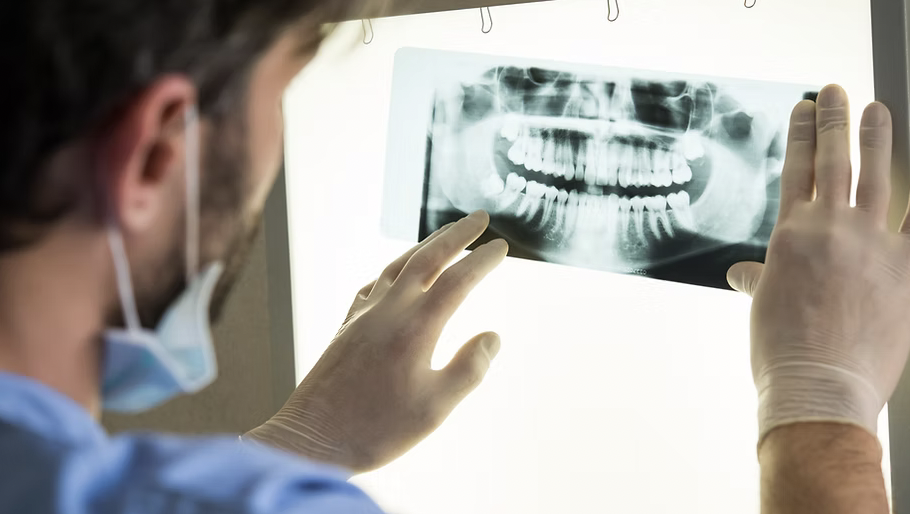 A doctor wearing gloves and a mask examining a dental X-ray displayed on a lightbox.