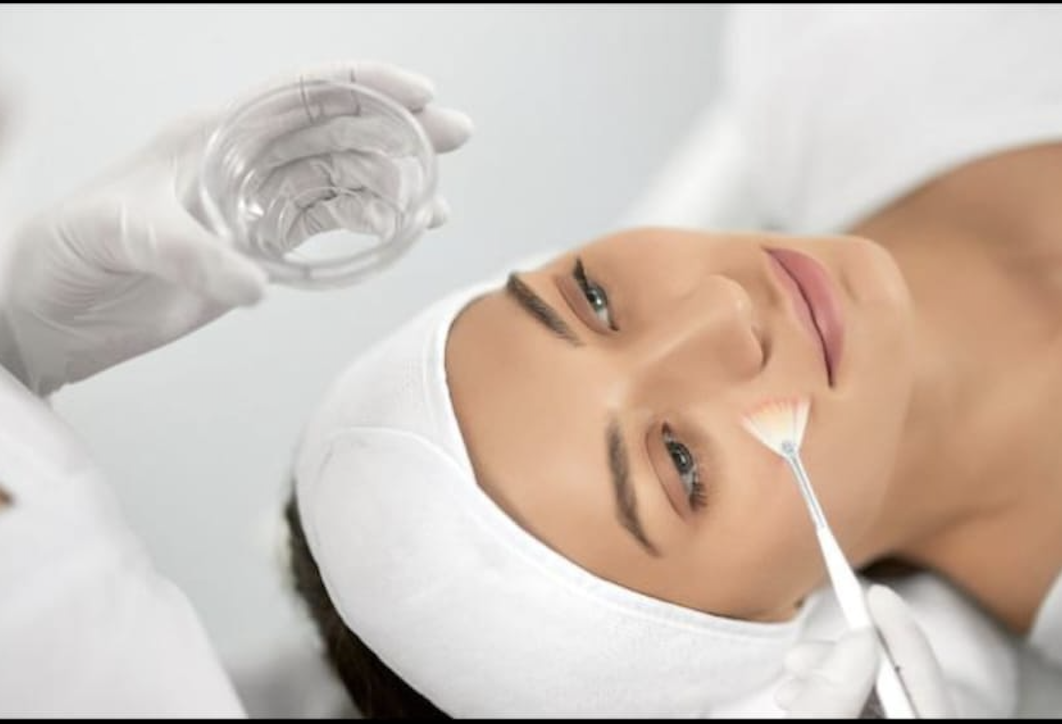 Tratamiento de Peeling Químico en Alicante