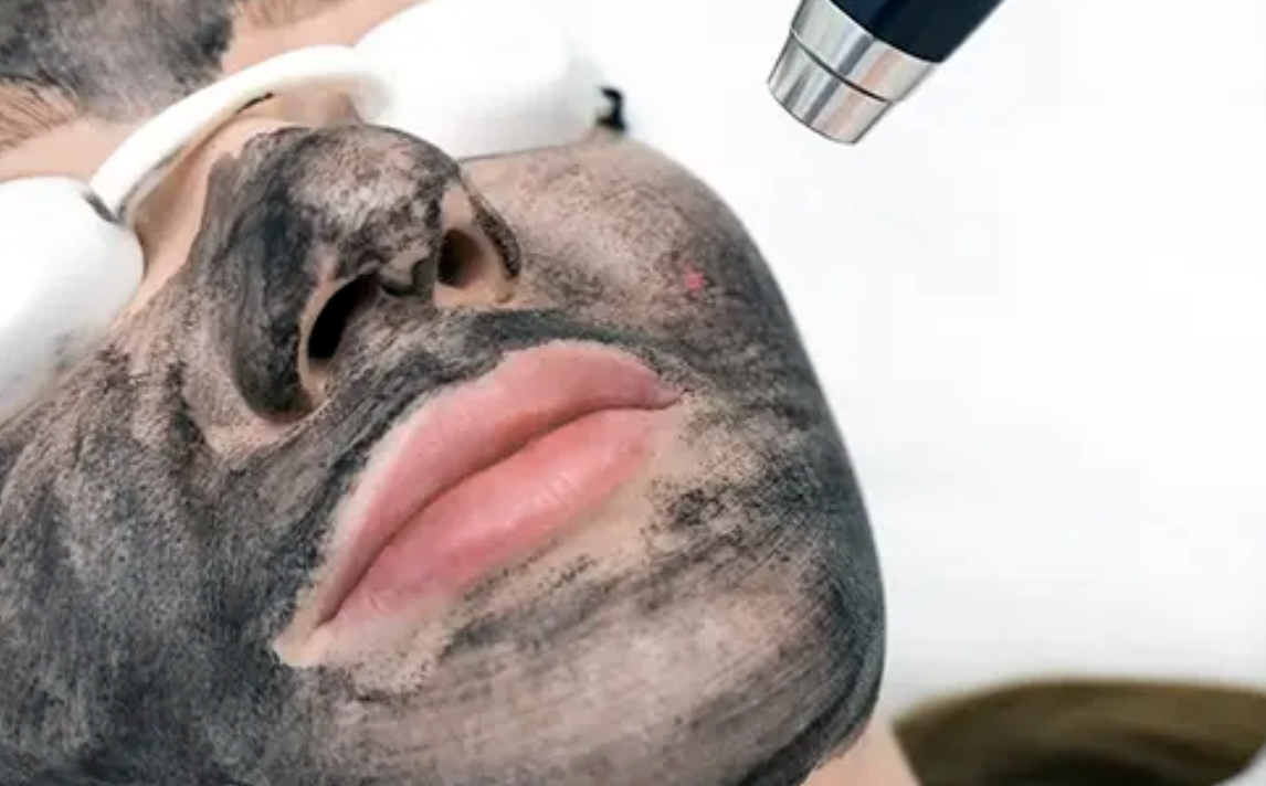 Tratamiento Despigmentación Facial en Alicante