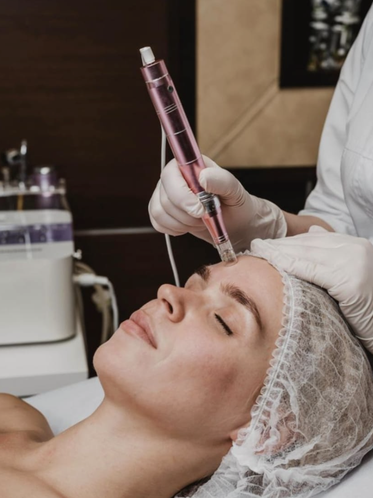 A woman receiving a cosmetic facial treatment with a micro-needling device in a clinical setting.