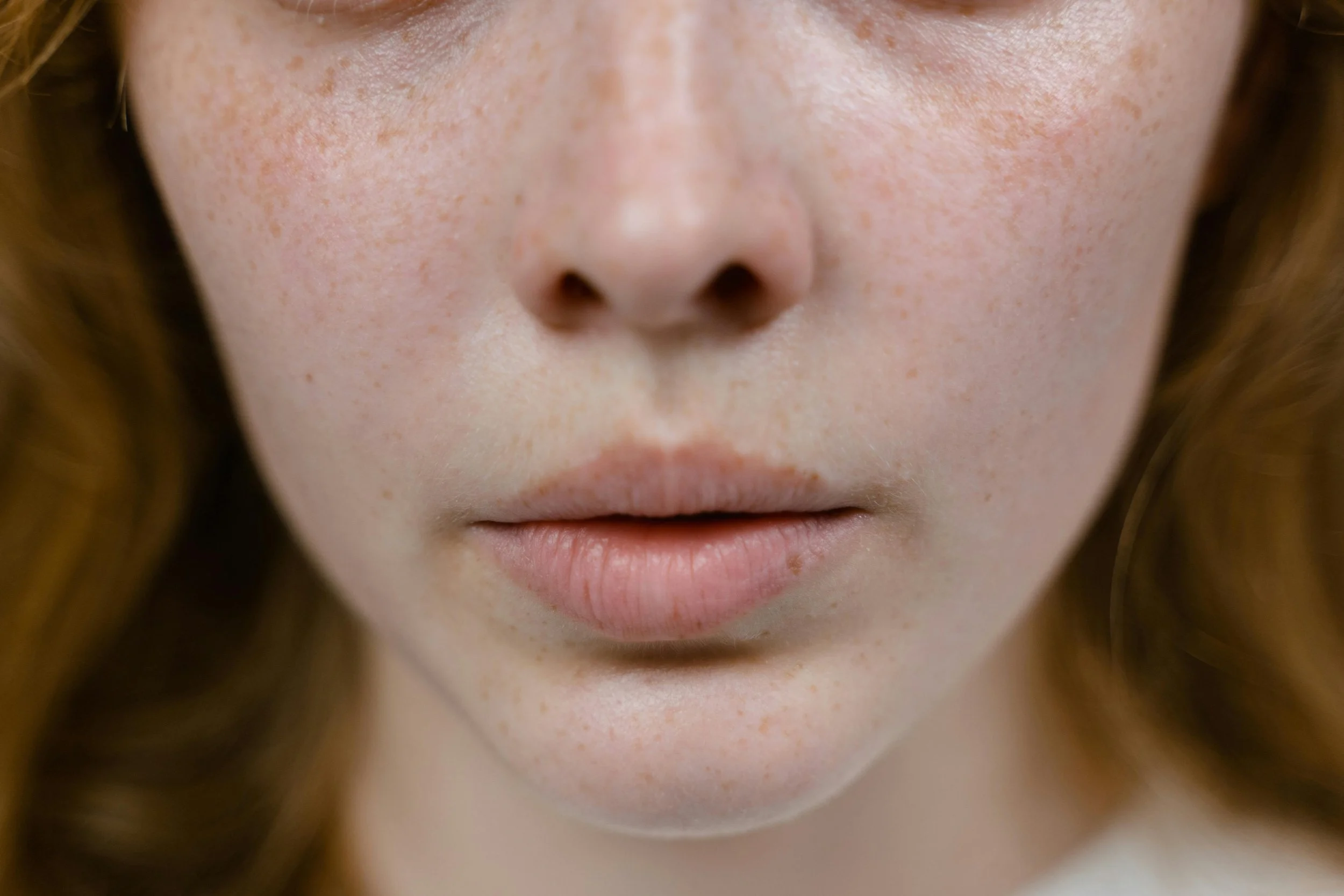 Sensitive Skin vs Damaged Skin Barrier: What’s the Difference?