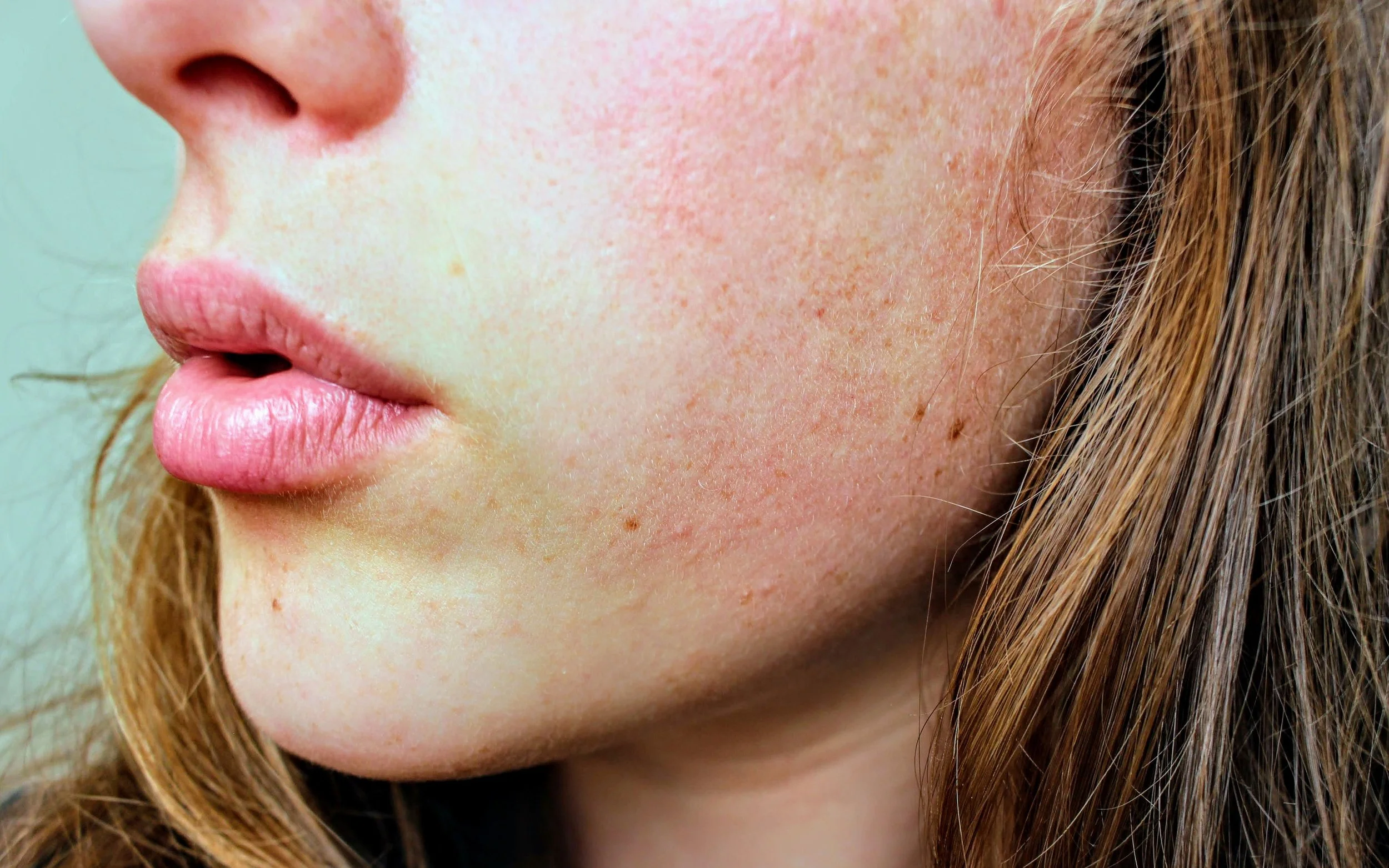 How to Calm Irritated Skin Naturally