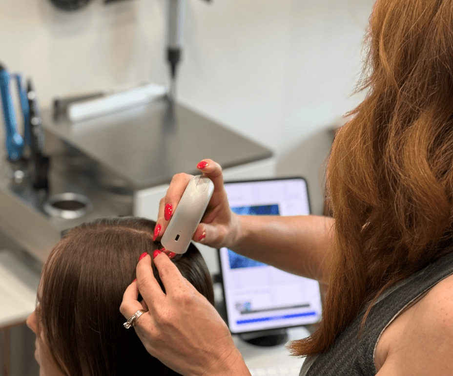 Hair Loss Starts at the Root: What to Expect from a Professional Hair &amp; Scalp Assessment