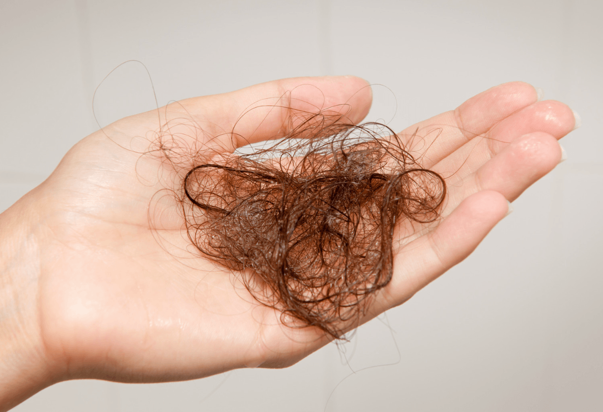 Why is my Hair Shedding?