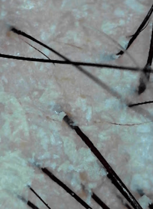 Why Is My Scalp So Itchy? 