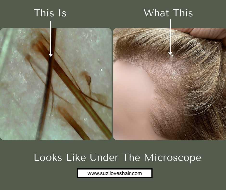Microscopic hair and scalp analysis used by a board-certified trichologist to evaluate frontal hairline thinning
