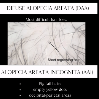 Trichoscopic image showing short regrowing hairs with findings that may be consistent with Diffuse Alopecia Areata.