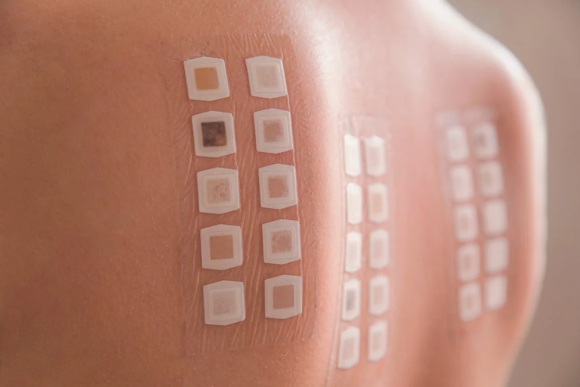 Allergy Patch Testing Brisbane Dermatology