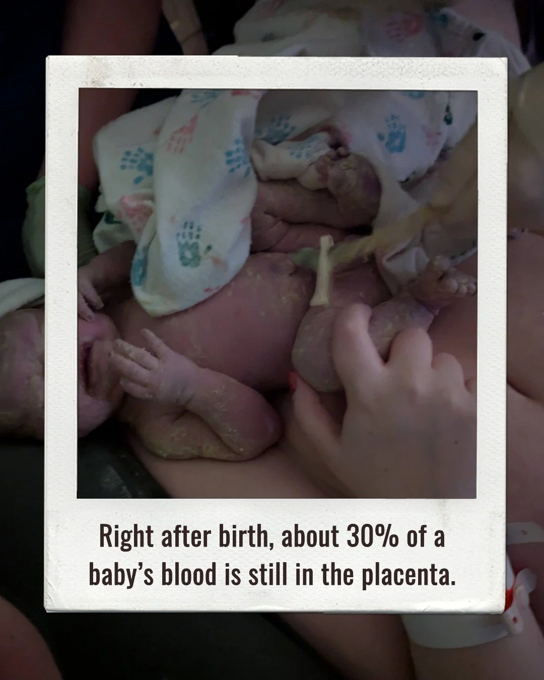Right after birth, about 30% of a baby&rsquo;s blood is still in the placenta! 😲

Giving the cord a little time before clamping allows that blood to finish transferring to your baby, even in the event of a c-section. 

As Doula's we educate families