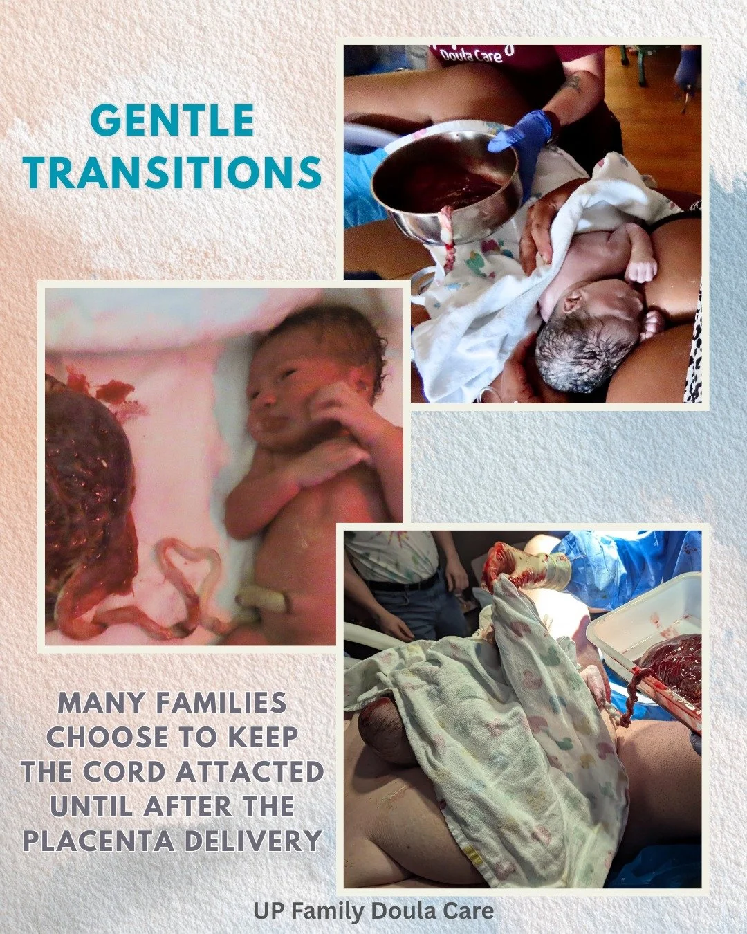 The pause before clamping! 🤍

There is a quiet beauty in allowing the cord to remain attached after birth.
As part of delayed cord clamping, this pause gives space for the placenta and baby to complete their transition together before separation.

I