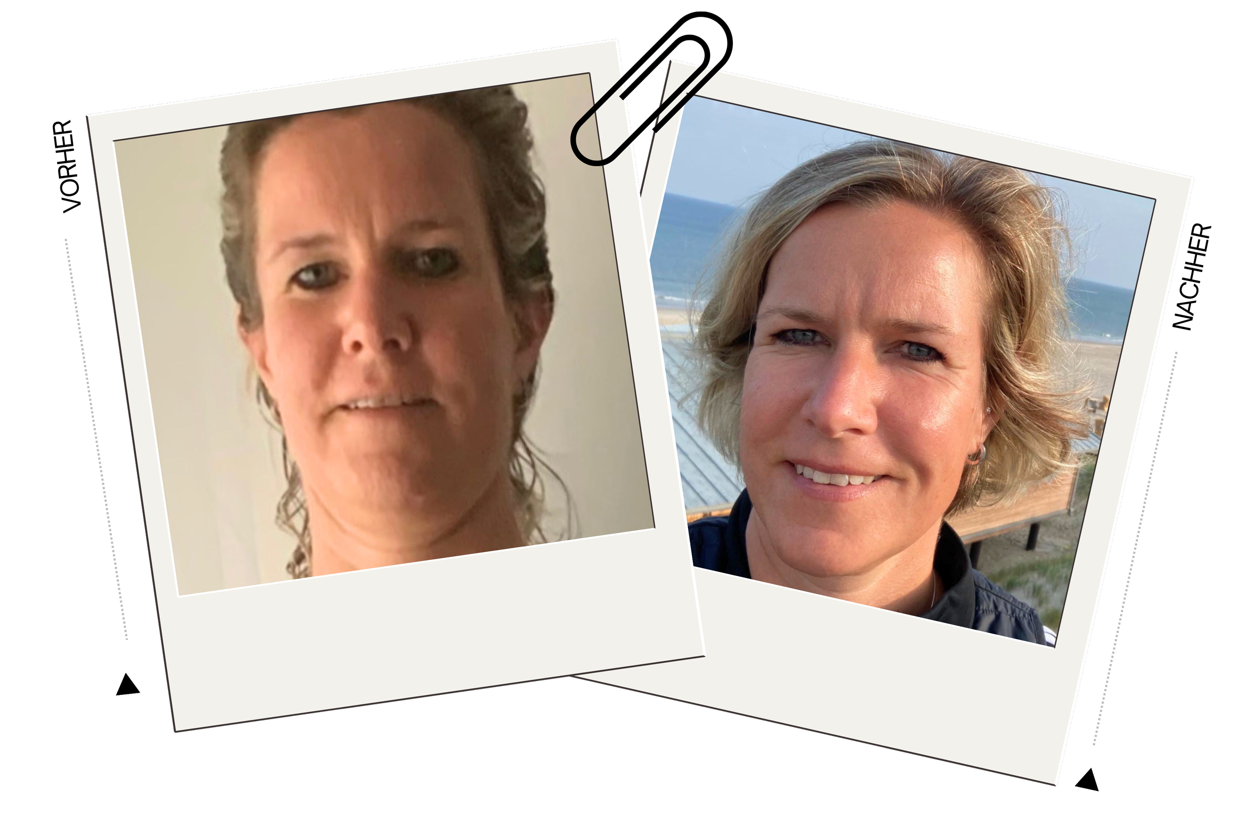 Susanne-Stoffwechsel-vorher-nachher