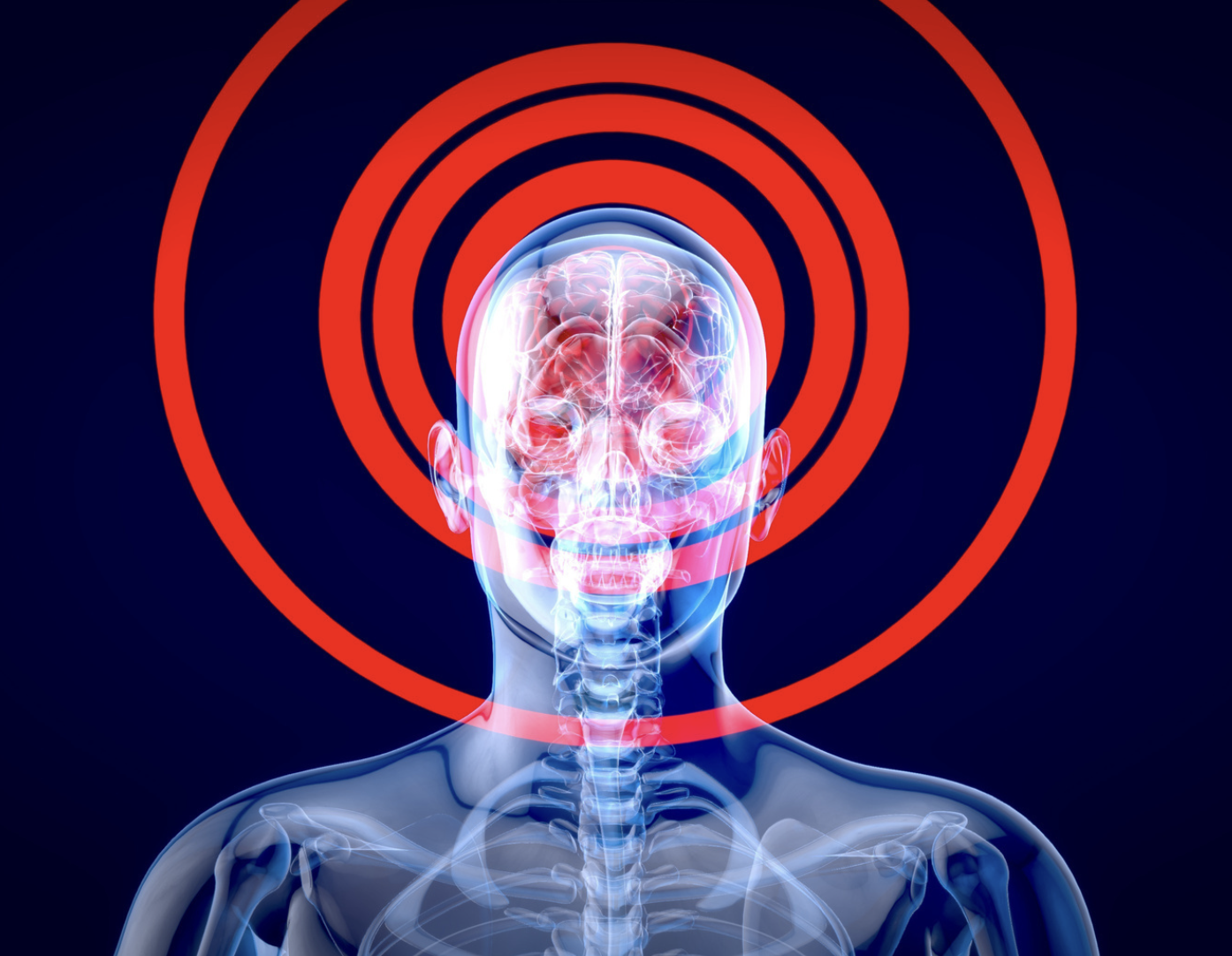 Digital illustration of a human head with an x-ray view showing the brain and skull, with red concentric circles behind the head indicating pain or focus.