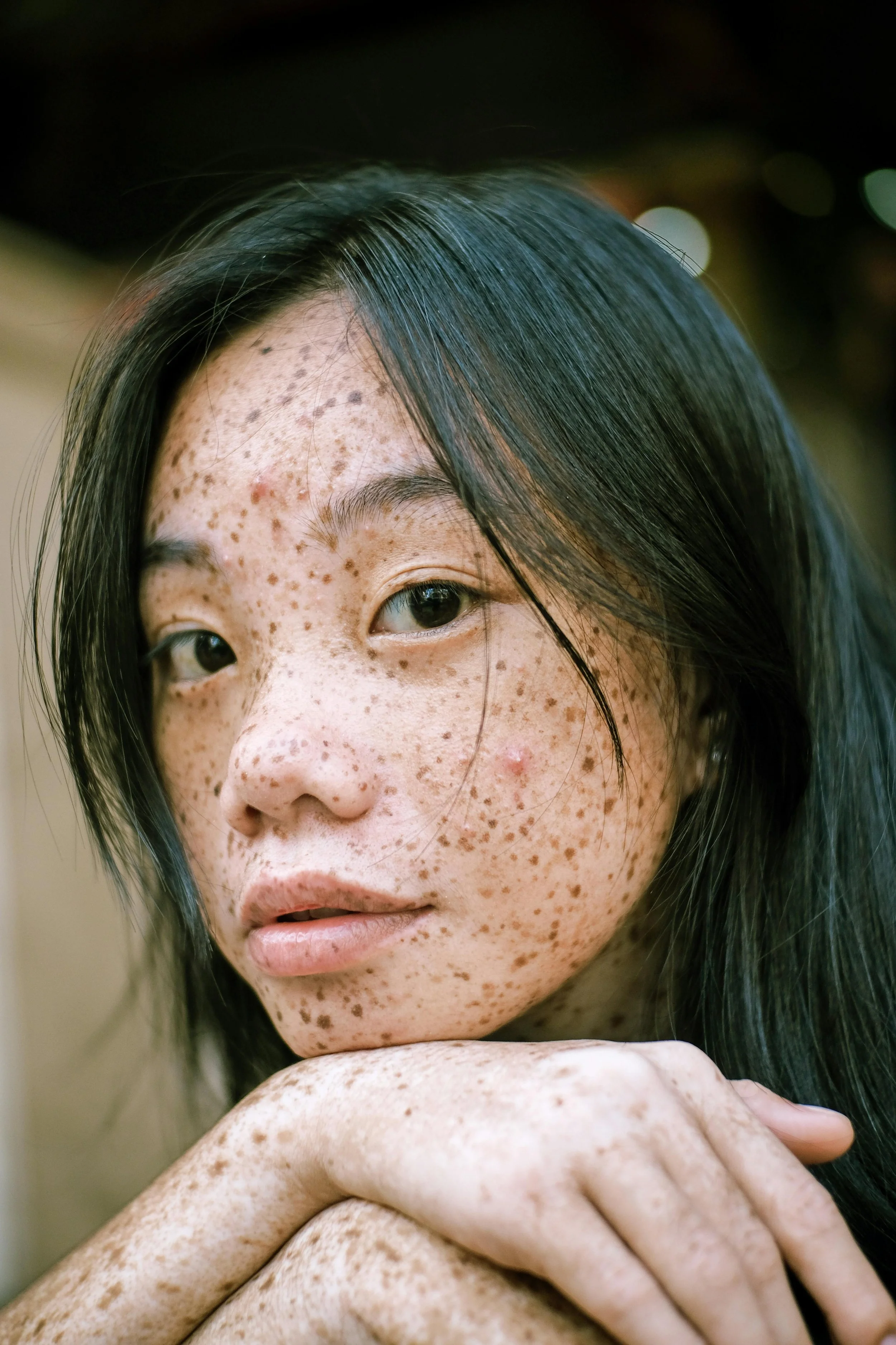 A close-up portrait of a young woman with dark hair and prominent freckles on her face, resting her chin on her hand.