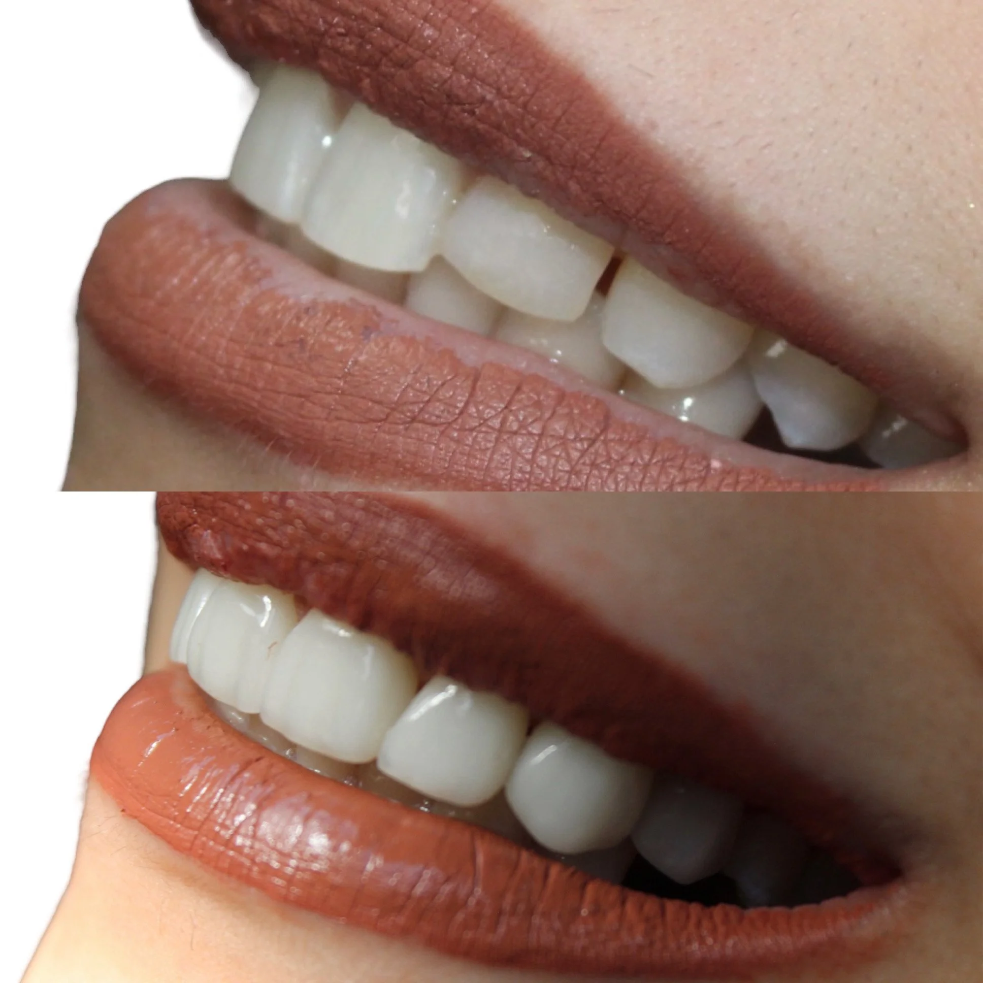 Close-up of a person's smile showing white teeth and lips with reddish-brown lipstick