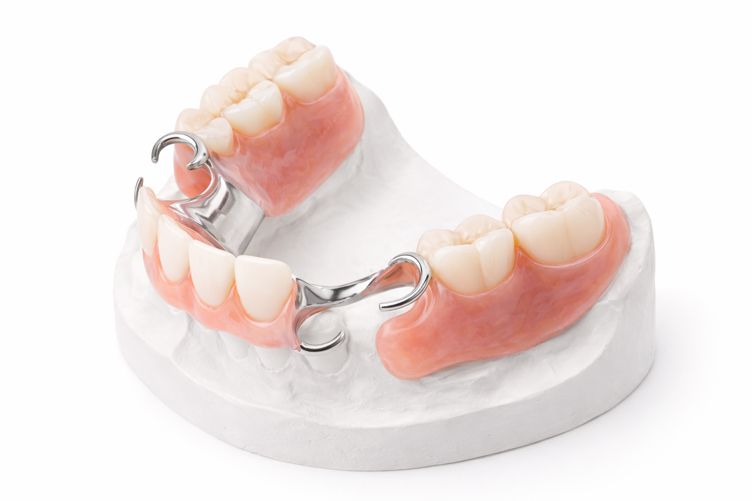 Partial Denture