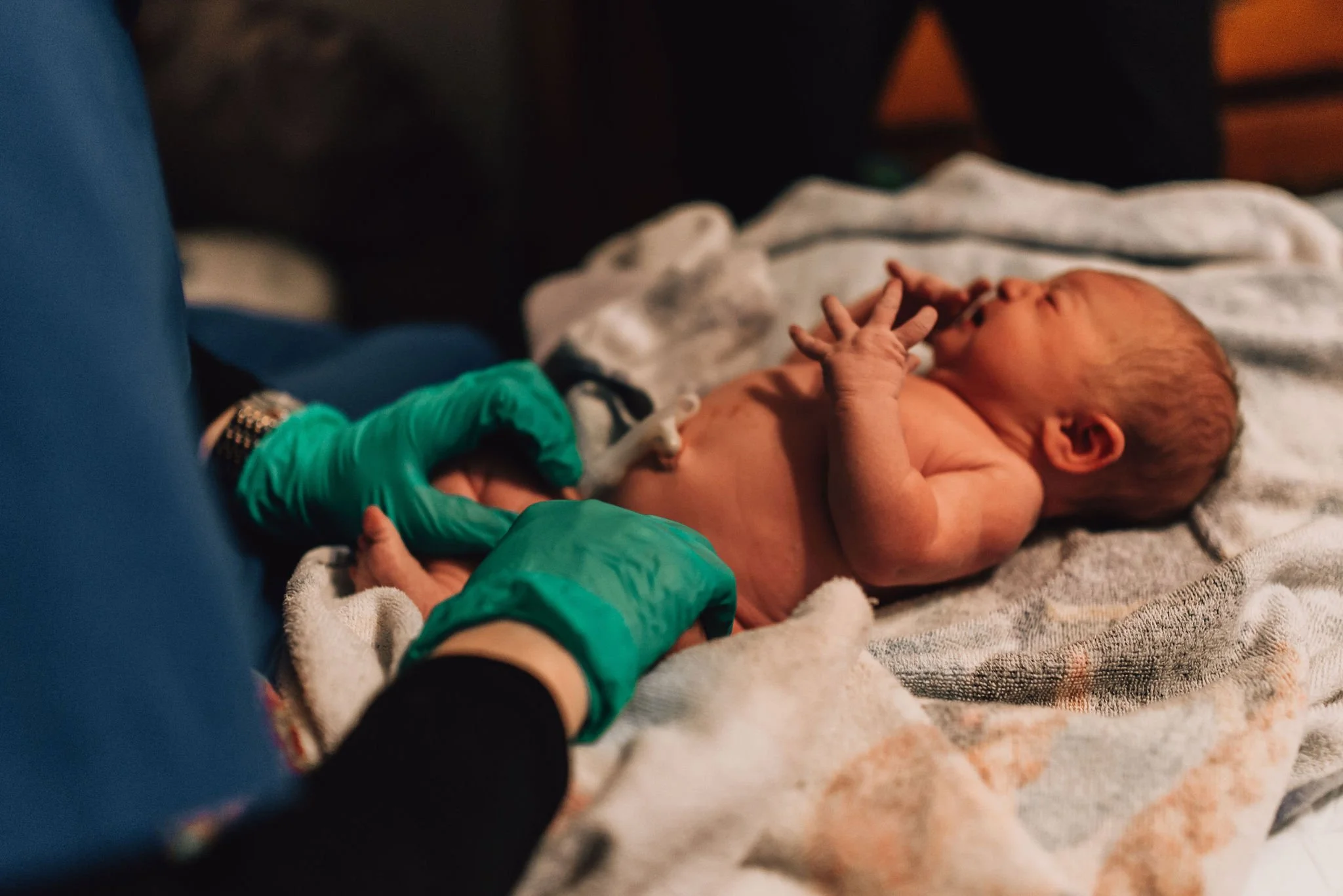 A newborn baby lying on a blanket, with a person wearing green gloves gently touching the baby’s side.