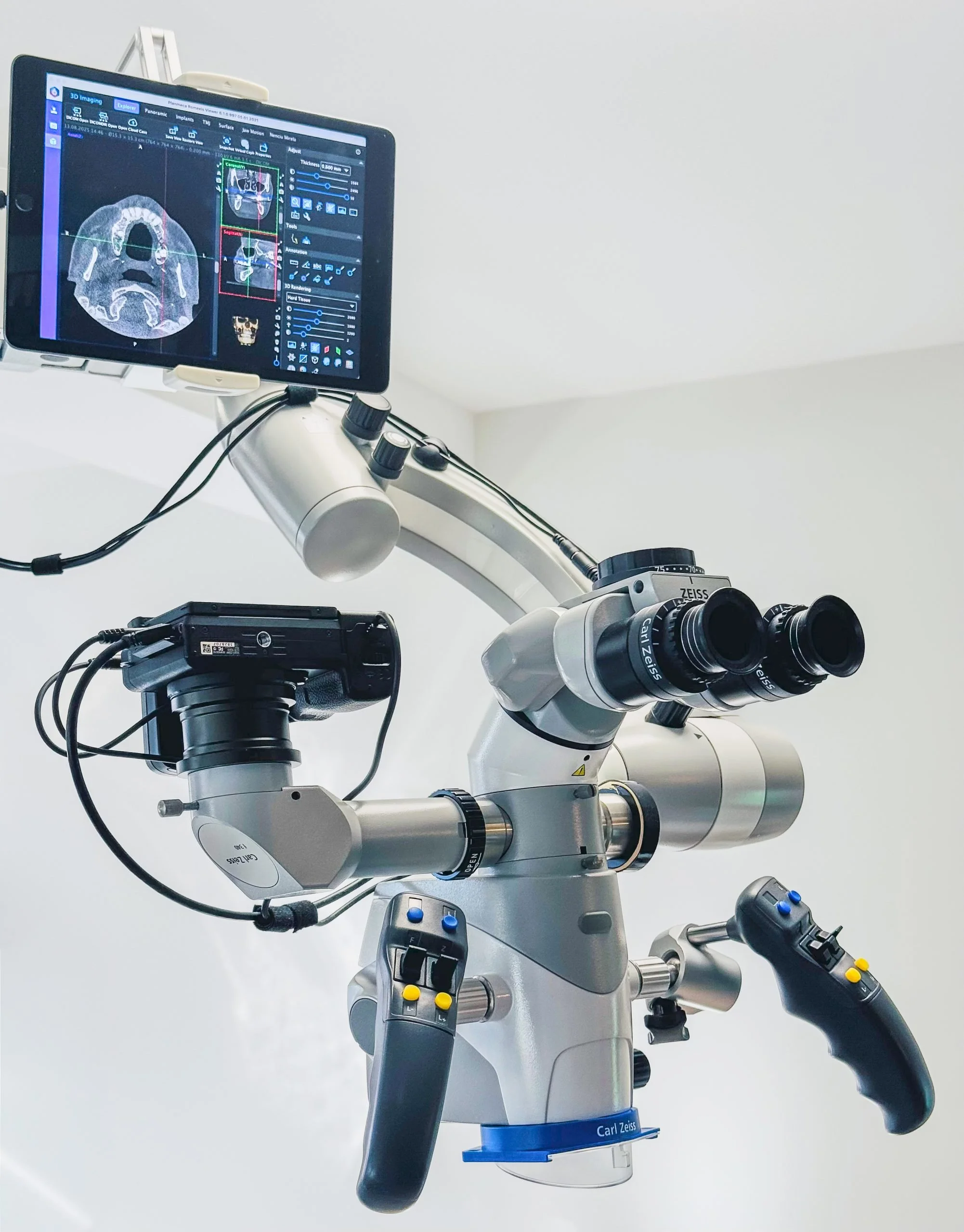 Close-up of a surgical, endodontic microscope Carl Zeiss with a digital screen showing a medical scan, mounted on a stand with various adjustment controls.