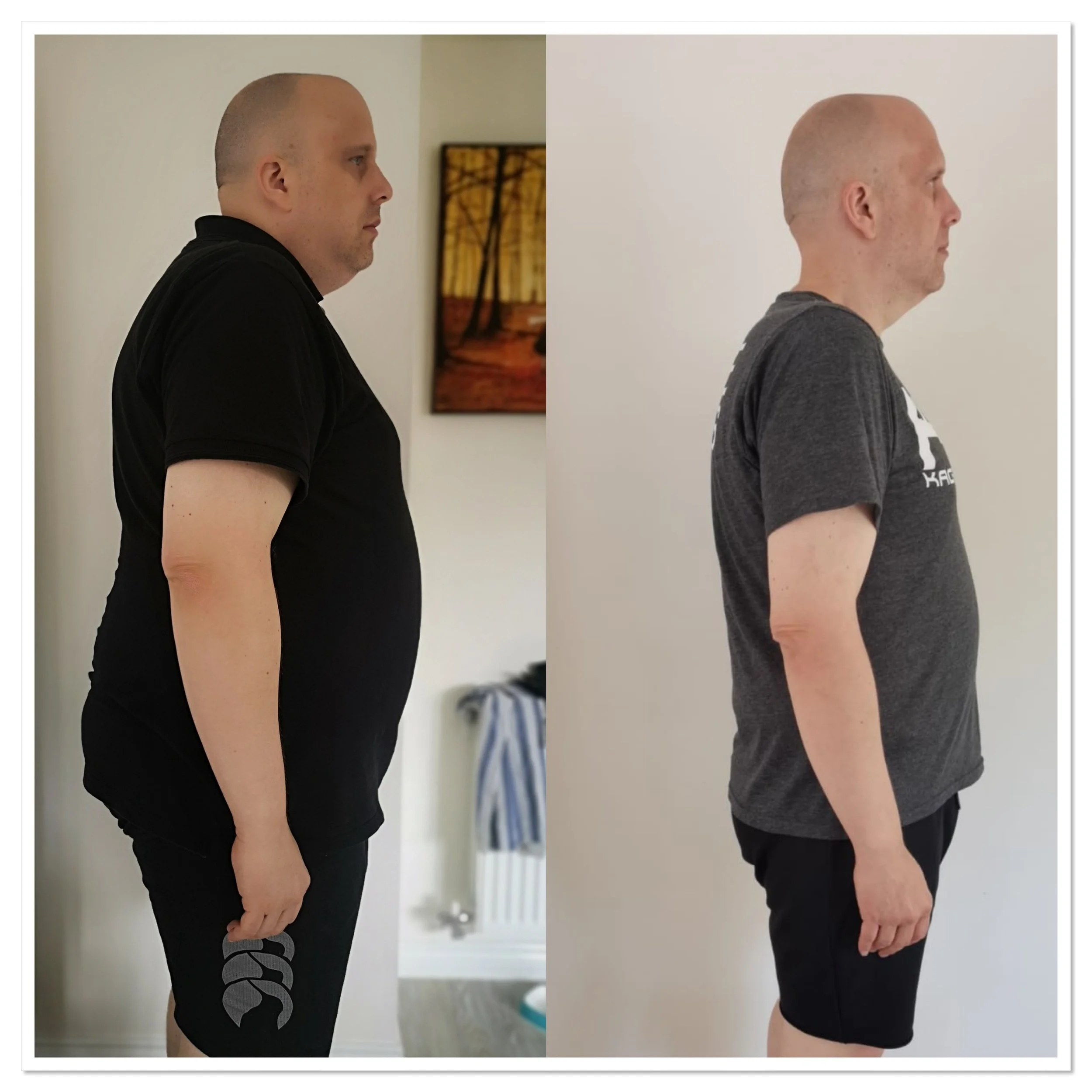 Side-by-side comparison of a body transformation before and after weight loss, standing in profile against a plain wall.