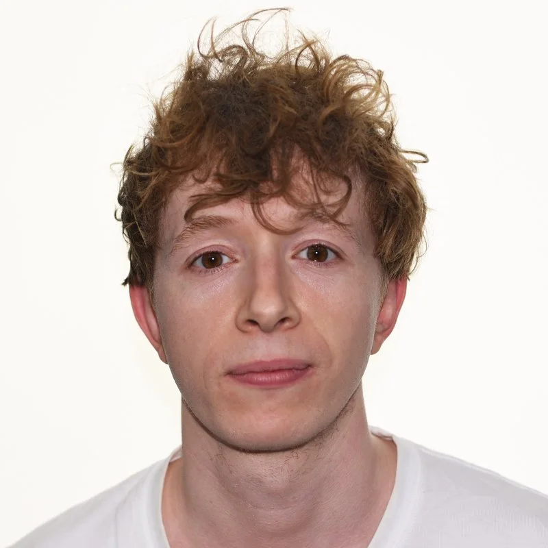 Episode 5- Dr Lloyd Steele: AI Reveals Hidden Immune Memory in Eczema &amp; Psoriasis