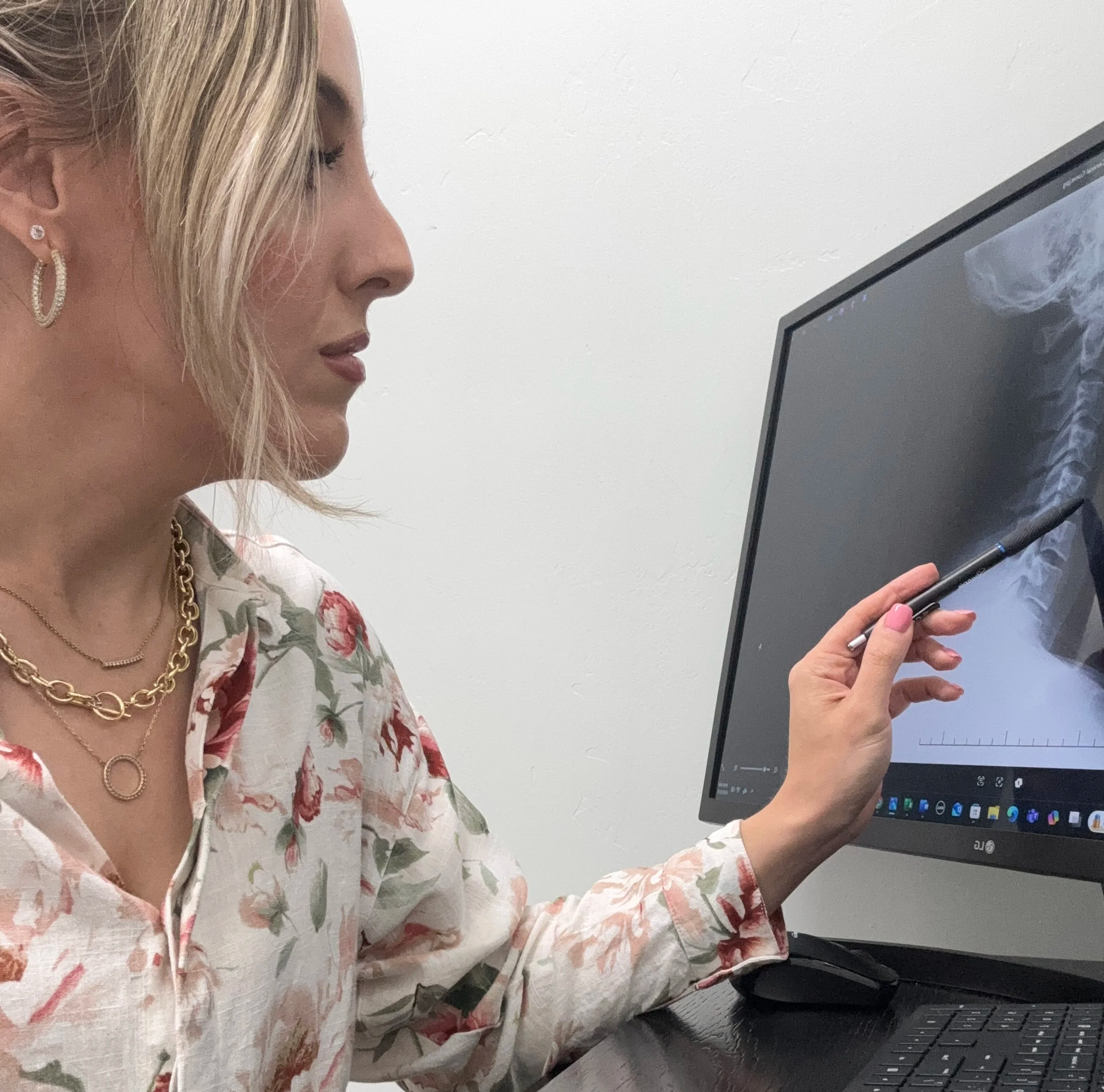 A woman with blonde hair and wearing floral clothing, jewelry, and earrings looks at an X-ray on a monitor, holding a pen in her right hand.