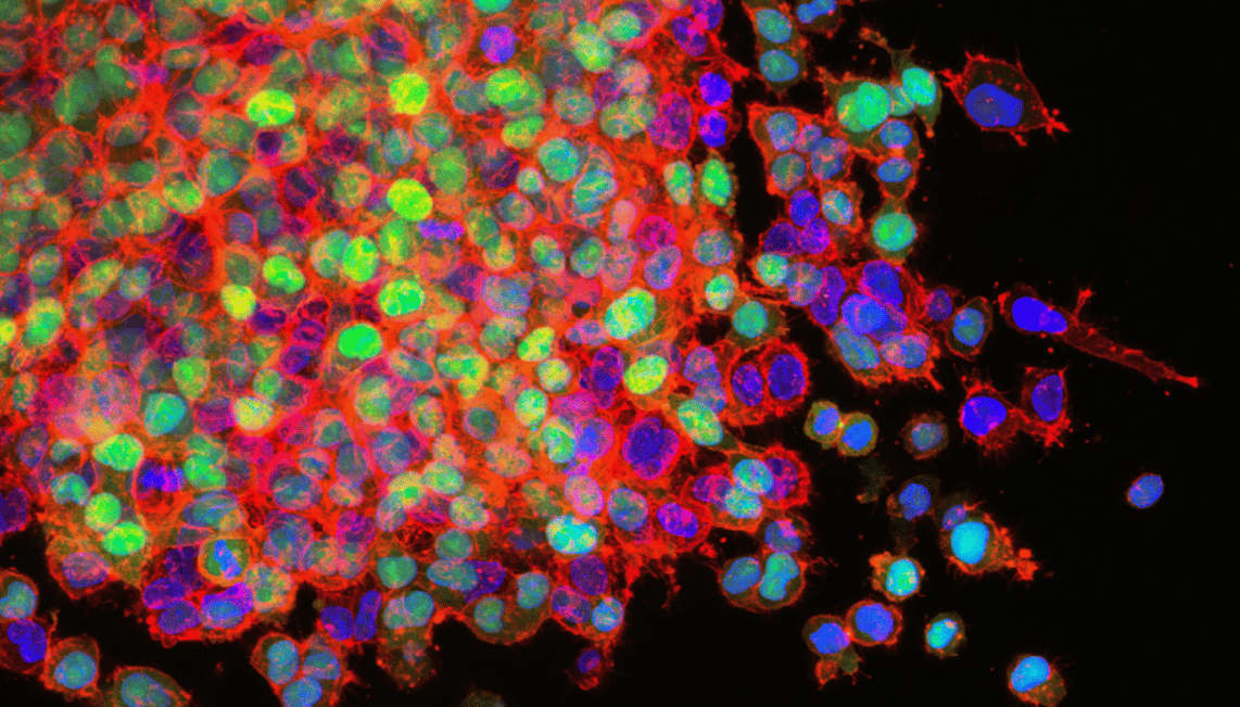 Organoides cerebrales para avanzar en la investigación neurológica