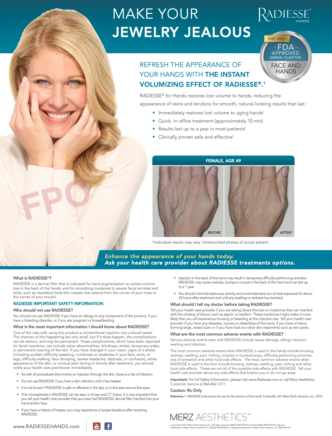 Concept/copy - Radiesse® in-office poster