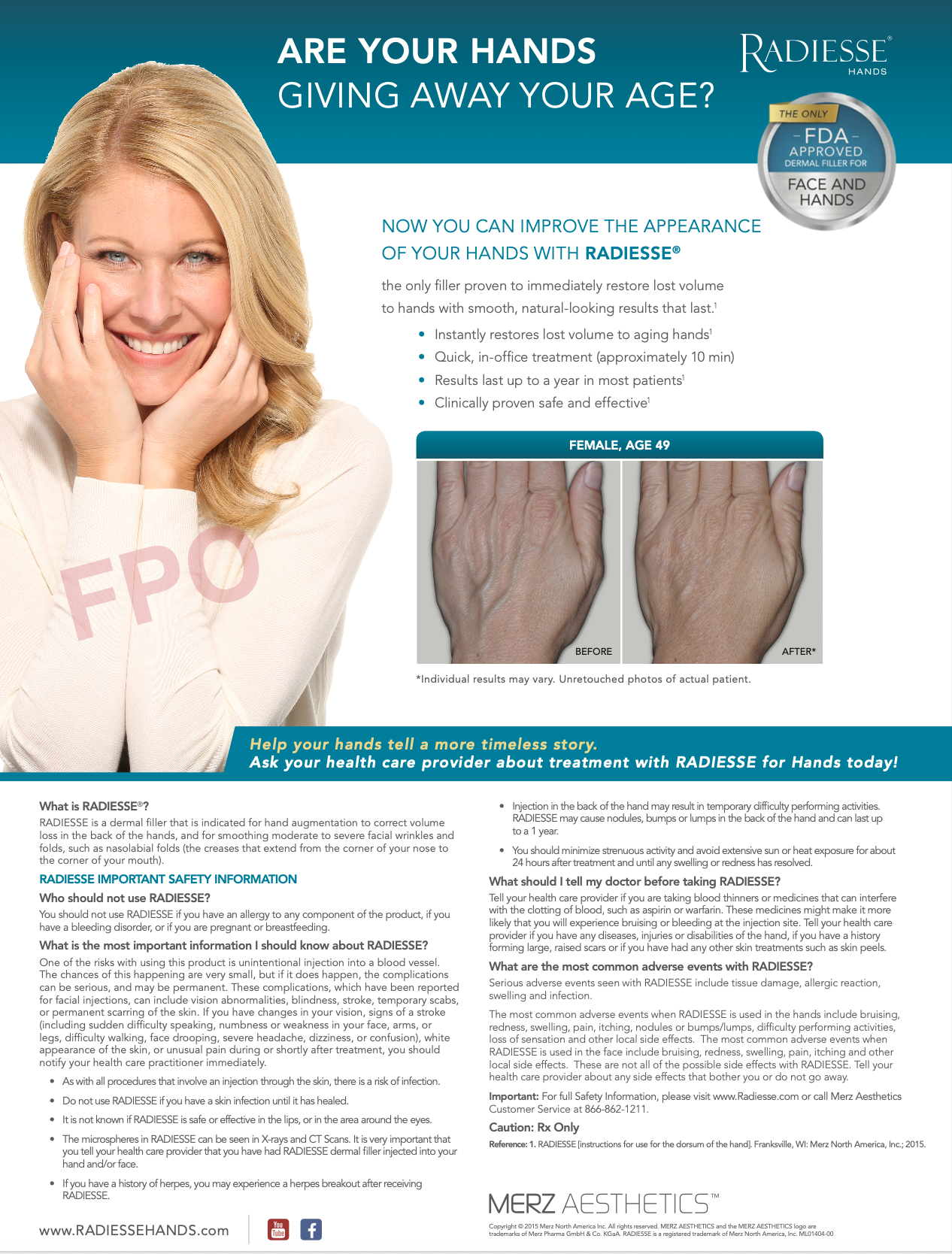 Concept/copy - Radiesse® in-office poster