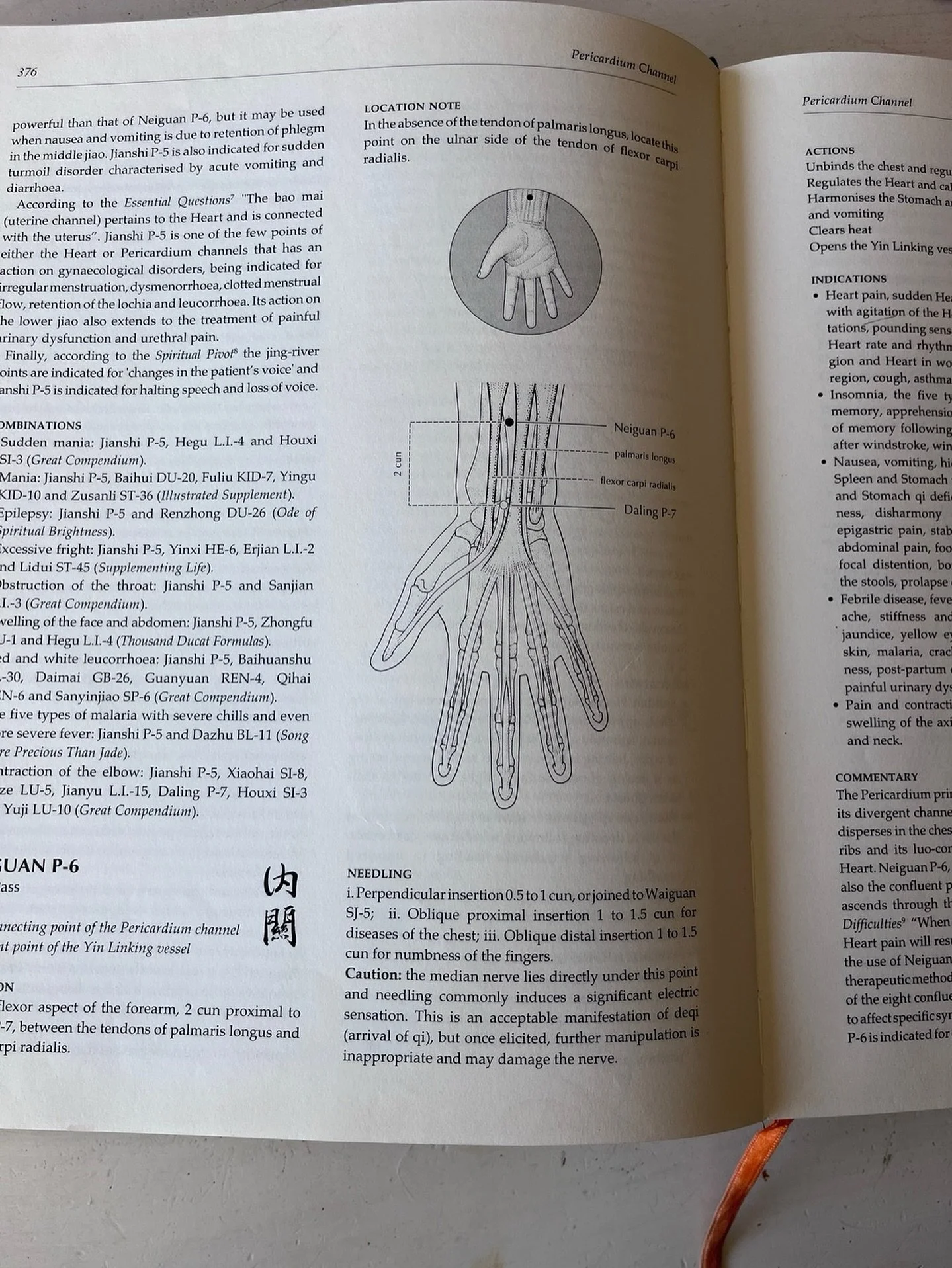 P E R I C A R D I U M 

🤍 The Pericardium, in TCM theory, is our heart&rsquo;s protector. It&rsquo;s the outer layer of the heart, physically protecting it. 

Clinically, we use Pericardium-6 to quiet the mind, alleviate nausea, open the chest to re