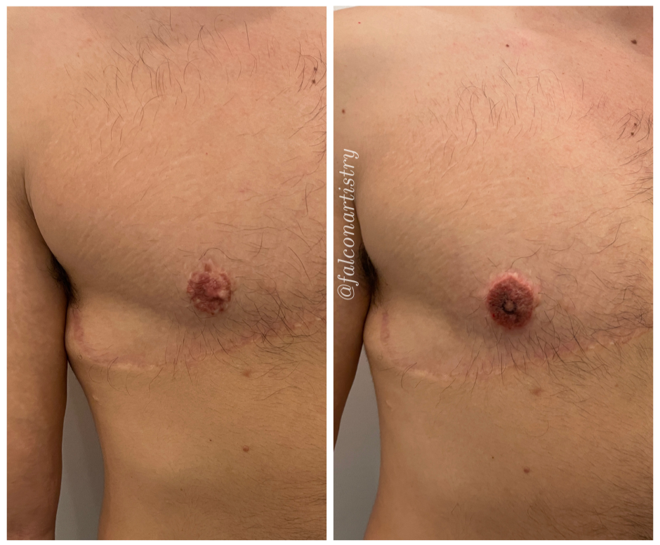 areola-portfolio-copy (11).png