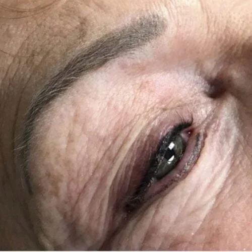 brows-IMG_8953-500x500.webp