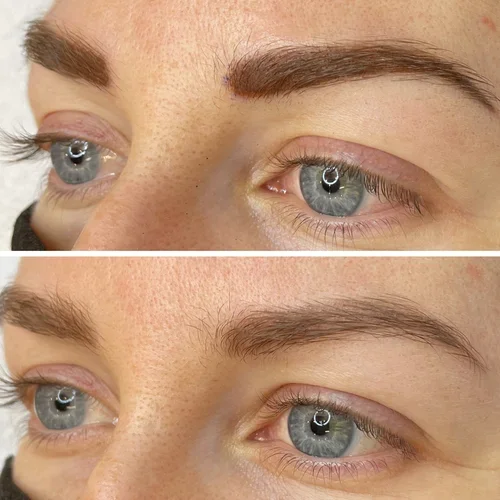 Brows-Healed.webp