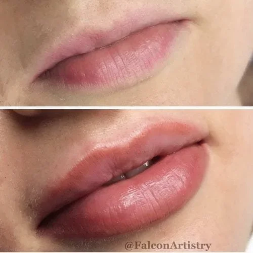 Lips-1-500x500.webp