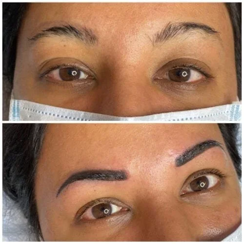 Brows-Revision-IMG_3567-500x500.webp