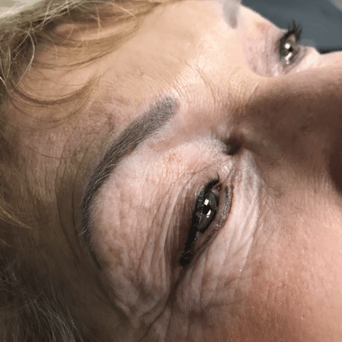 Brow-3-500x500.webp