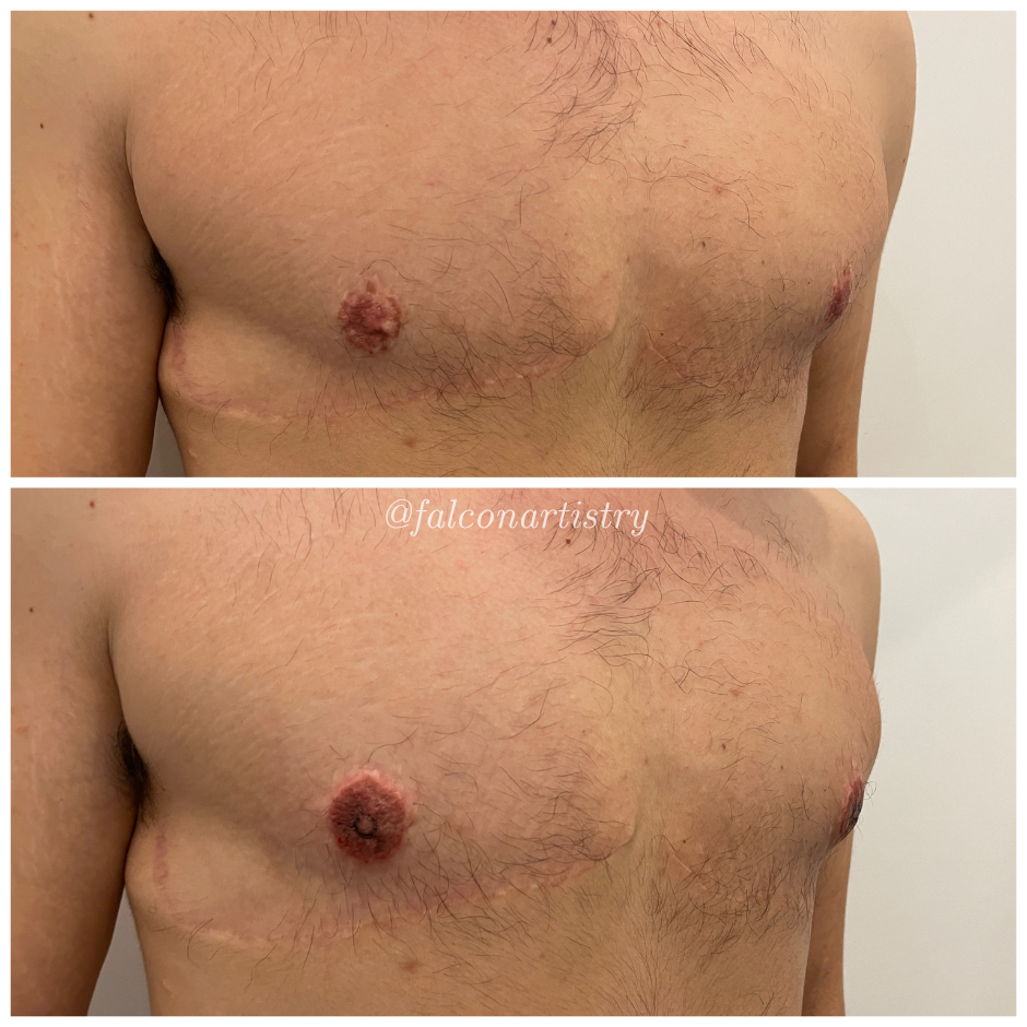 areola-portfolio-copy (13).png