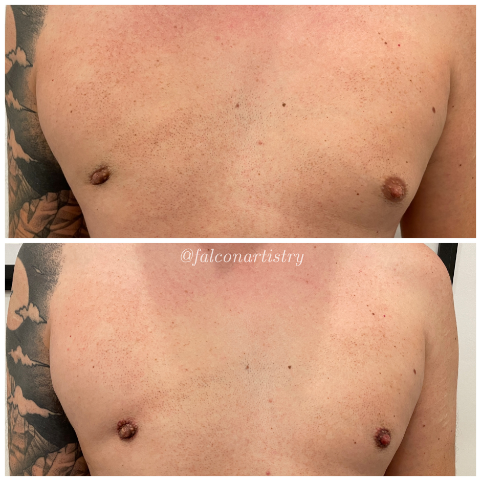 areola-portfolio-copy (9).png