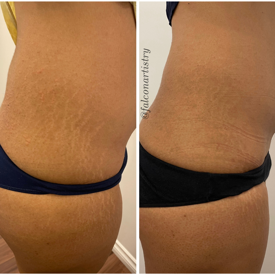 Areola-portfolio (4).png