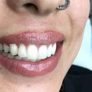 Lip-Tattoo-500x500.webp