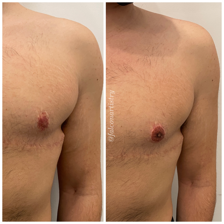 areola-portfolio-copy (12).png