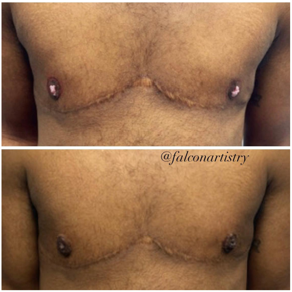 BEFORE AND AFTER TEMPLATES (2).png