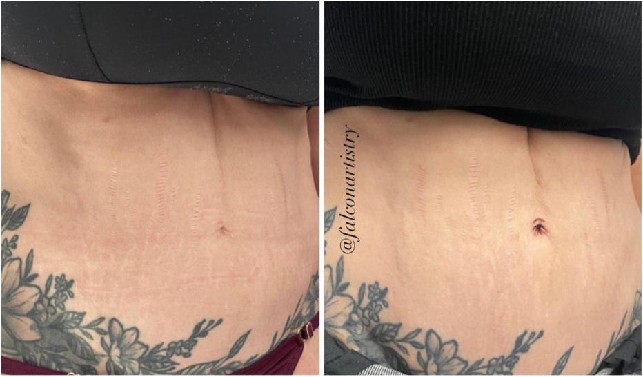 BEFORE AND AFTER TEMPLATES (4).png