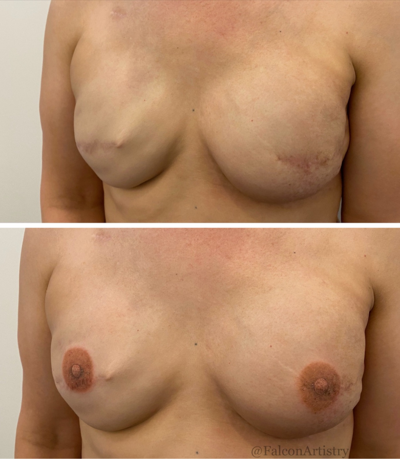 1st session 3D appearance nipple tattoos on a flat surface 