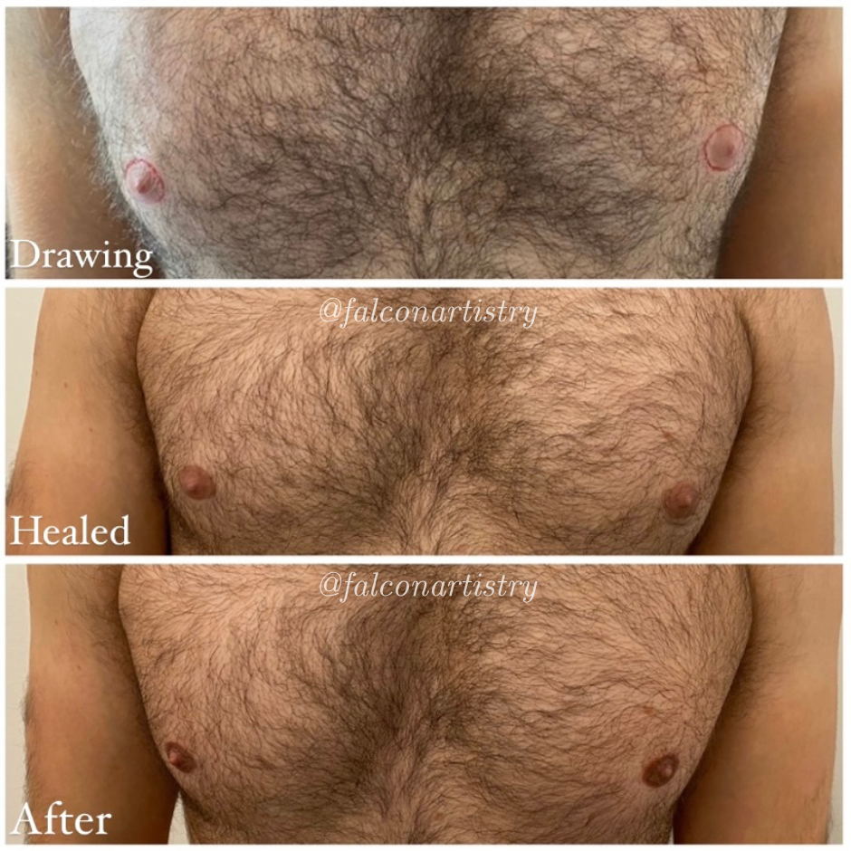 areola-portfolio-copy (6).png
