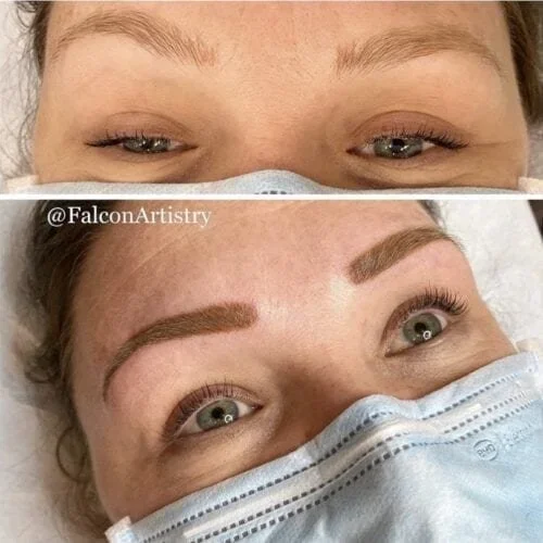 Brows-Revision-IMG_2555-500x500.webp