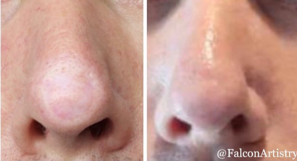 nose retexturing-cropped.png