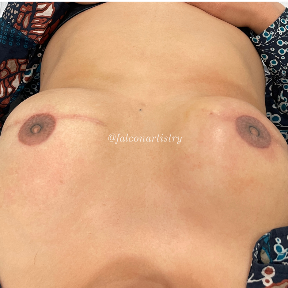 Areola-portfolio (2).png