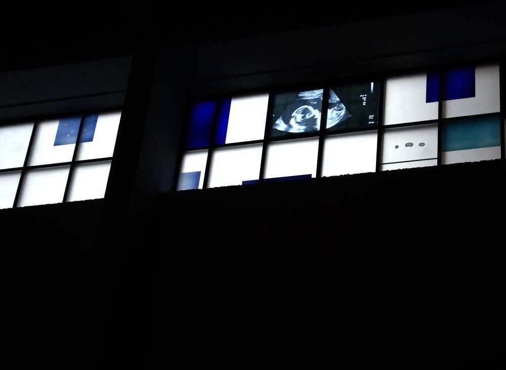 Fenster mit mehreren Glasstücken, eines zeigt eine Ultraschallaufnahme eines Fötus.