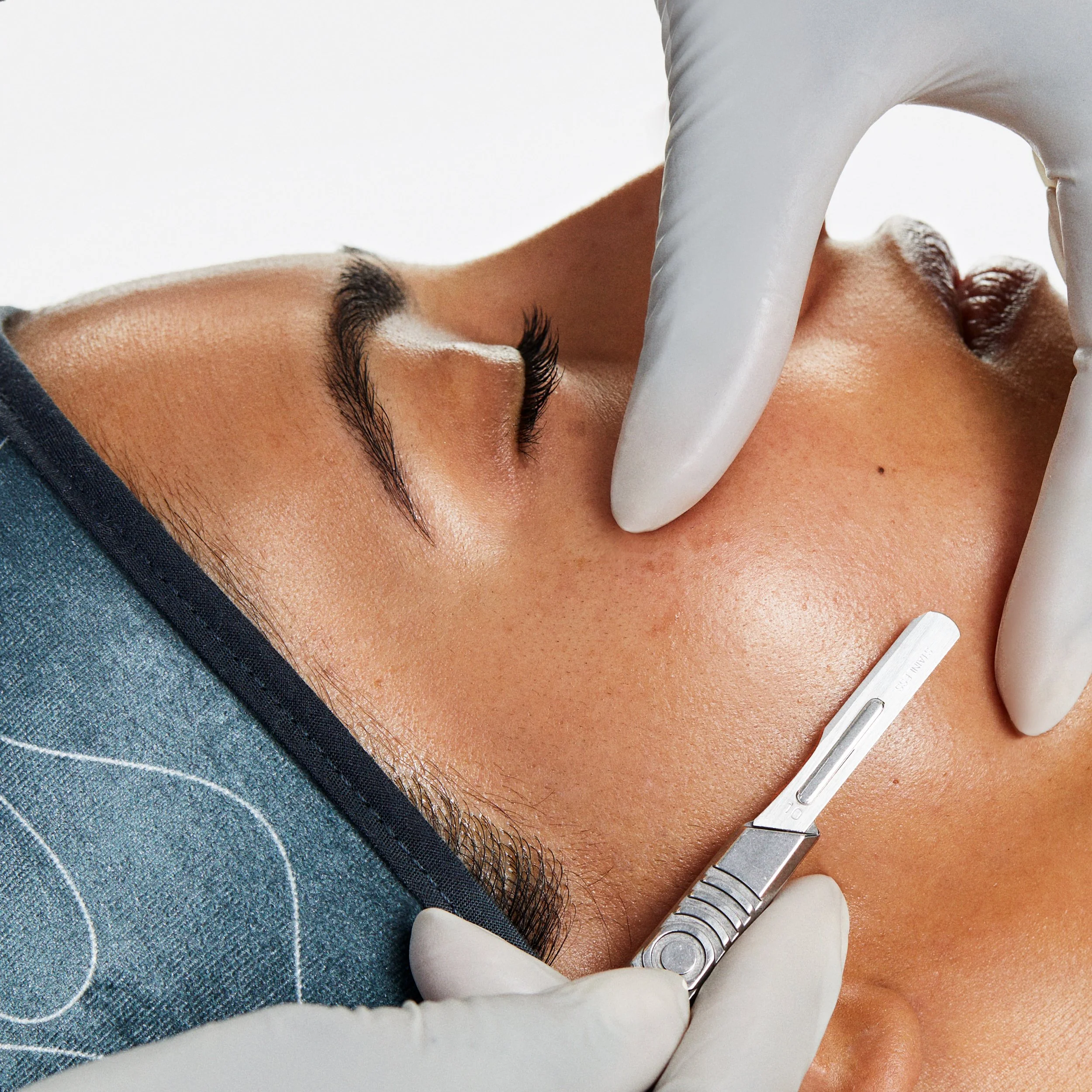 Why I Love &amp; Recommend Dermaplaning + Dermalogica